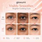 Glowumi EyeLift LED Under Eye Mask